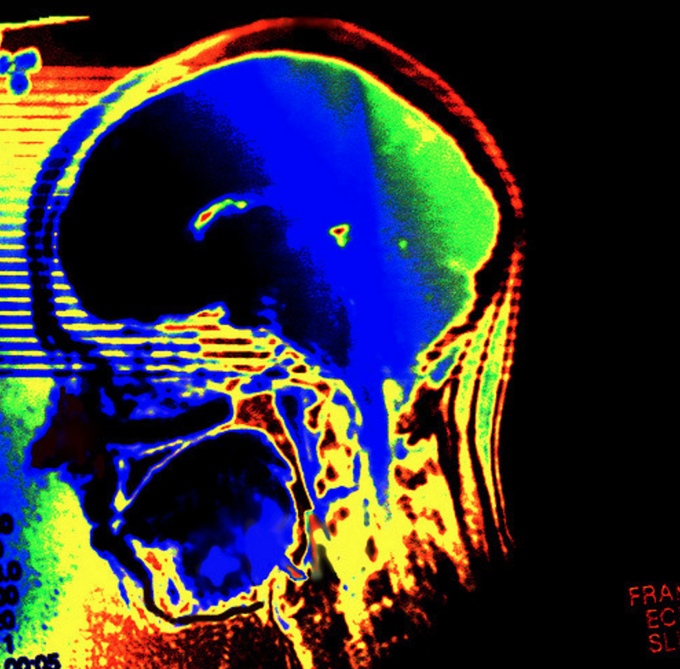 Coloured scan of human head